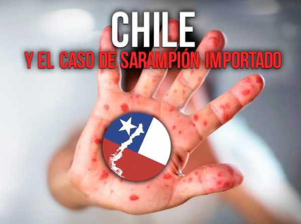 Chile y el caso de sarampión importado